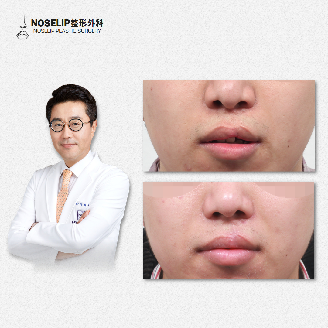 六、成都黄开亮修复鼻预约挂号指南？教你快速找到他