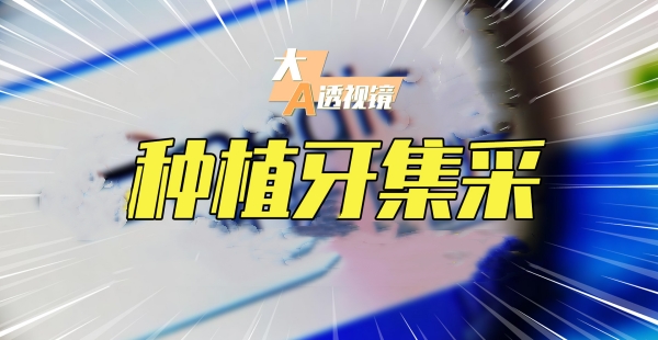 卡爾斯種植體的性價(jià)比：價(jià)格與適用人群