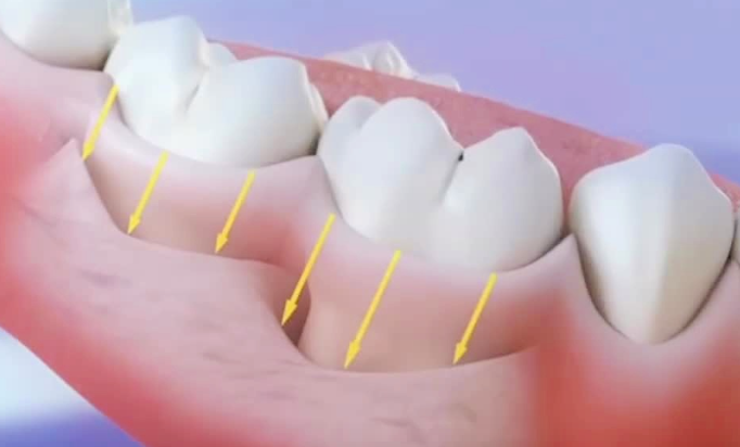 湛江陈海增口腔诊所，精良设备与专科化治疗，它表现如何？
