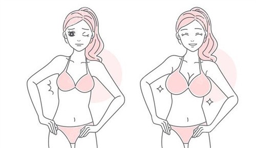 南京潘峰隆胸怎么样？16年临床经验+5C动感丰胸技术口碑好评