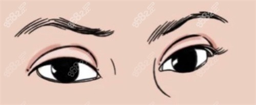 大连刘志刚医生团队靠谱吗？高难度眼修复技术+患者实测