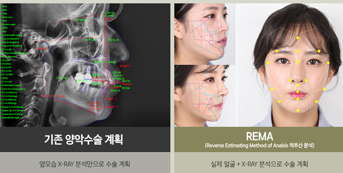 韩国菲斯莱茵整形外科