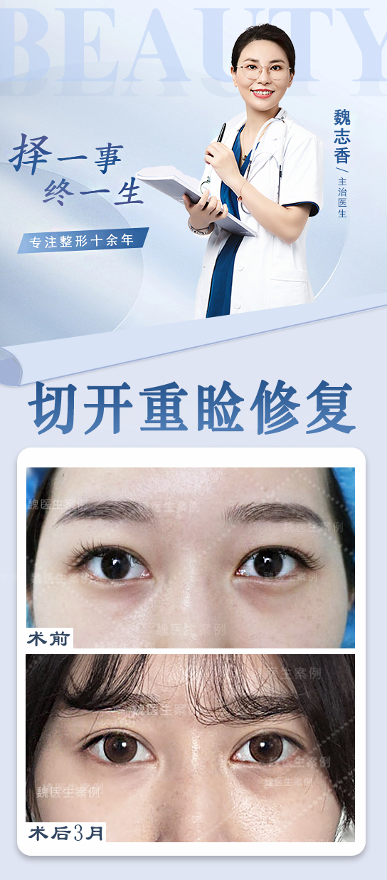 宜兴华星医疗美容机构是正规的吗？卫健委可查资质，双眼皮修复10000+起