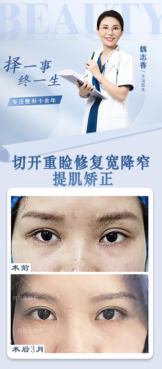 北京京美假体隆胸价格及优势