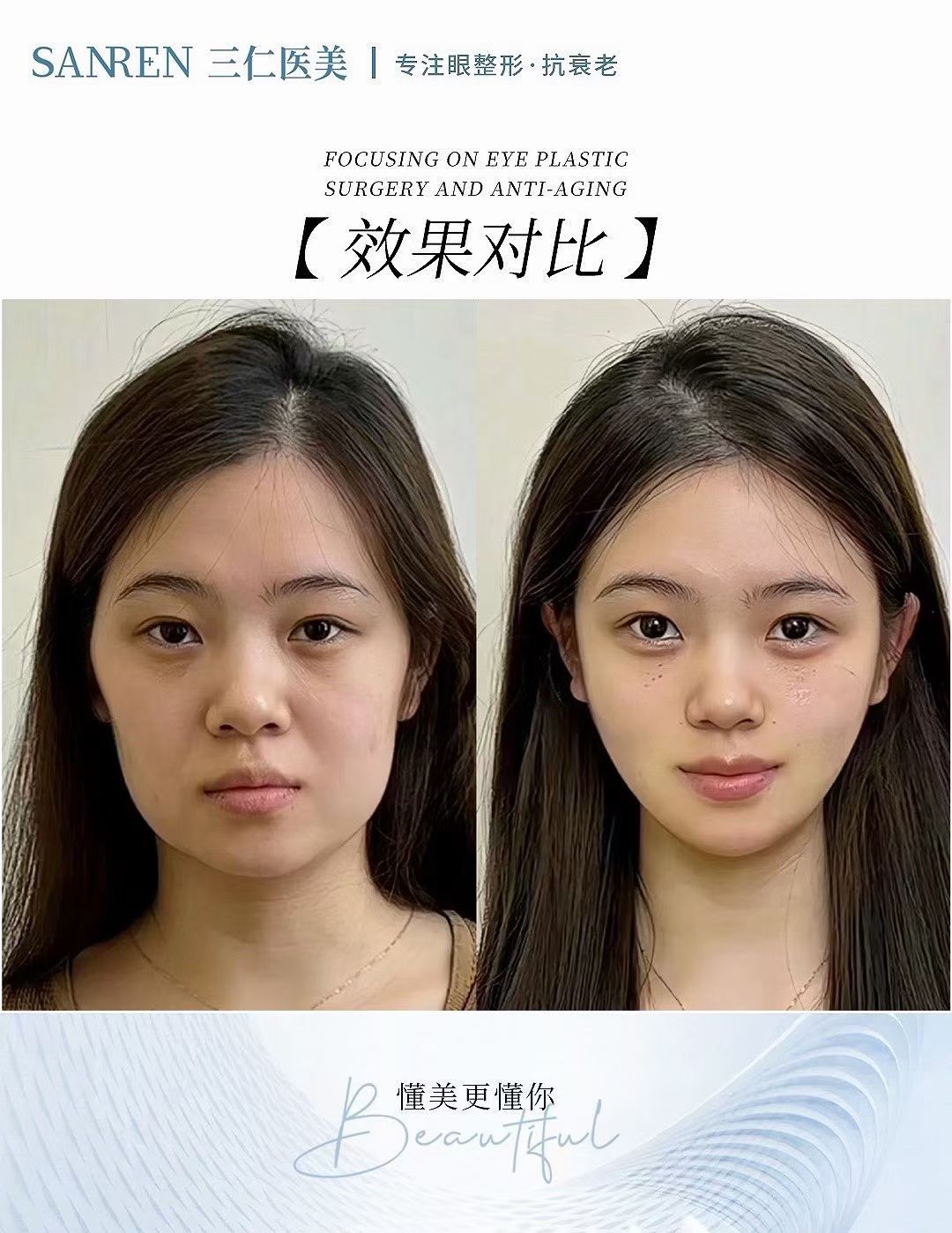 北京加减美整形假体隆胸价格及特点