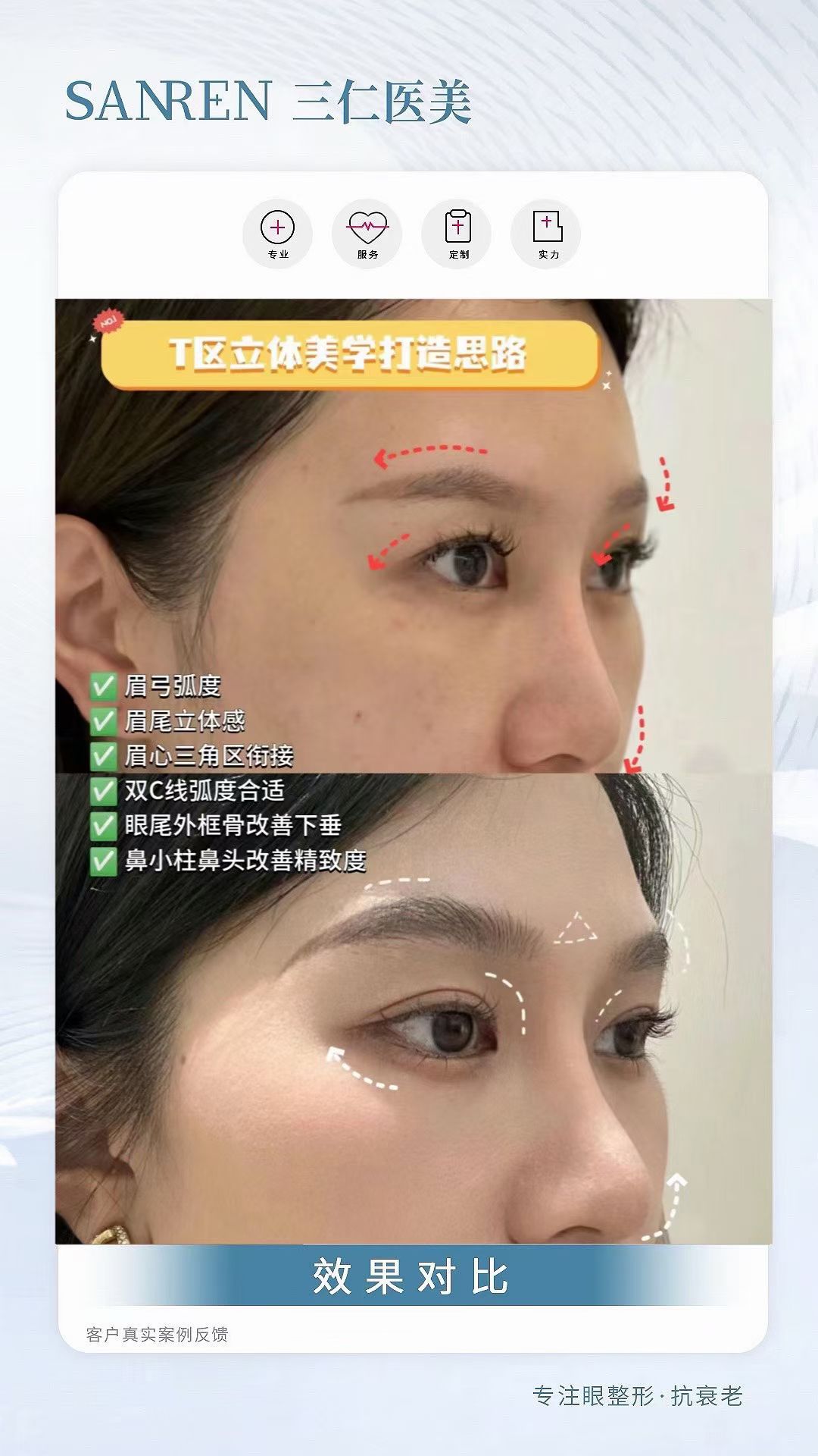 北京八大处假体隆胸价格及技术特色www.8682.cc