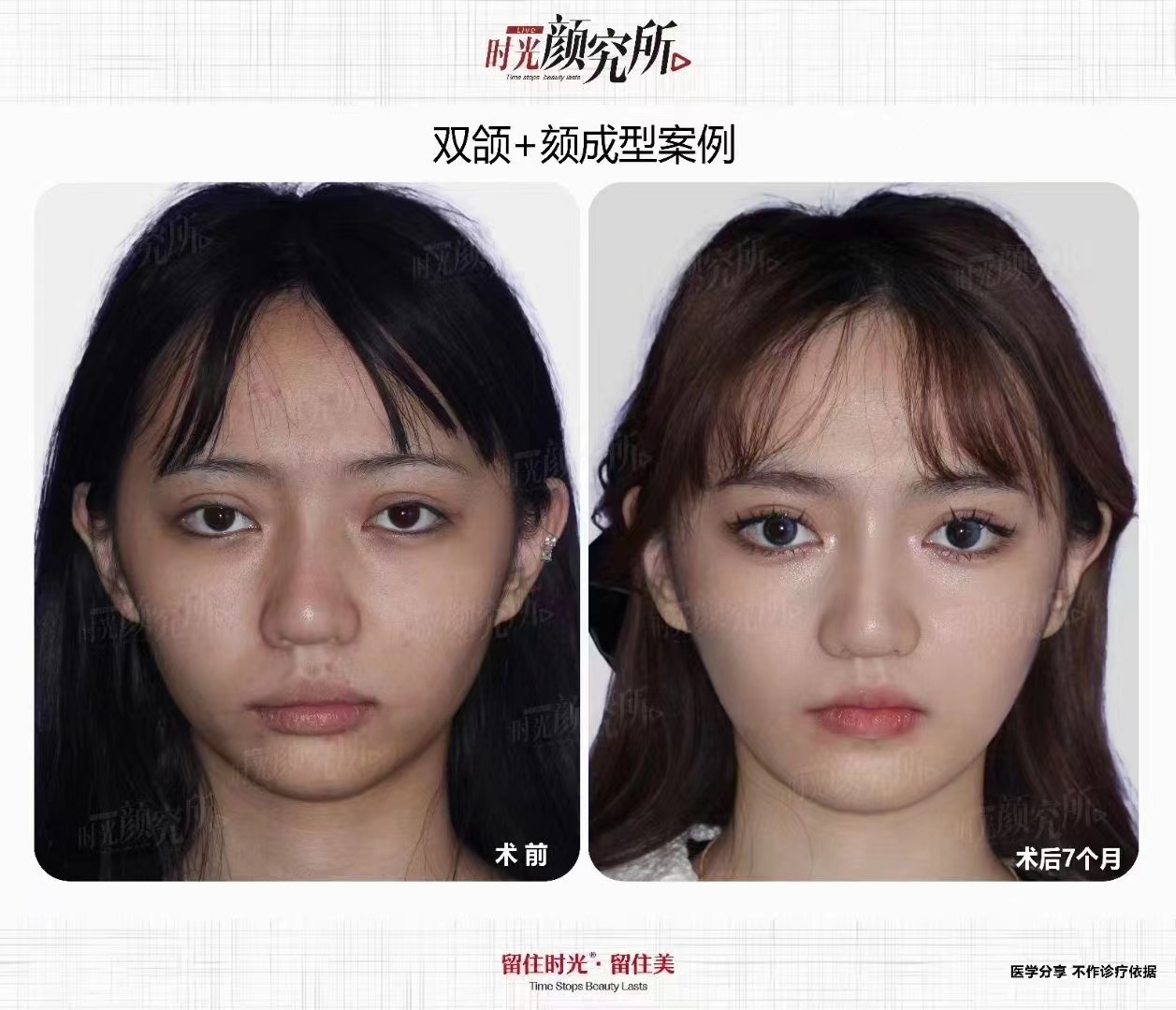 徐永丰私人定制鼻整形的独特优势