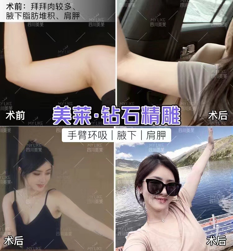 蔡躍波面吸+提升組合價(jià)格：一站式解決問題，性價(jià)比更突出