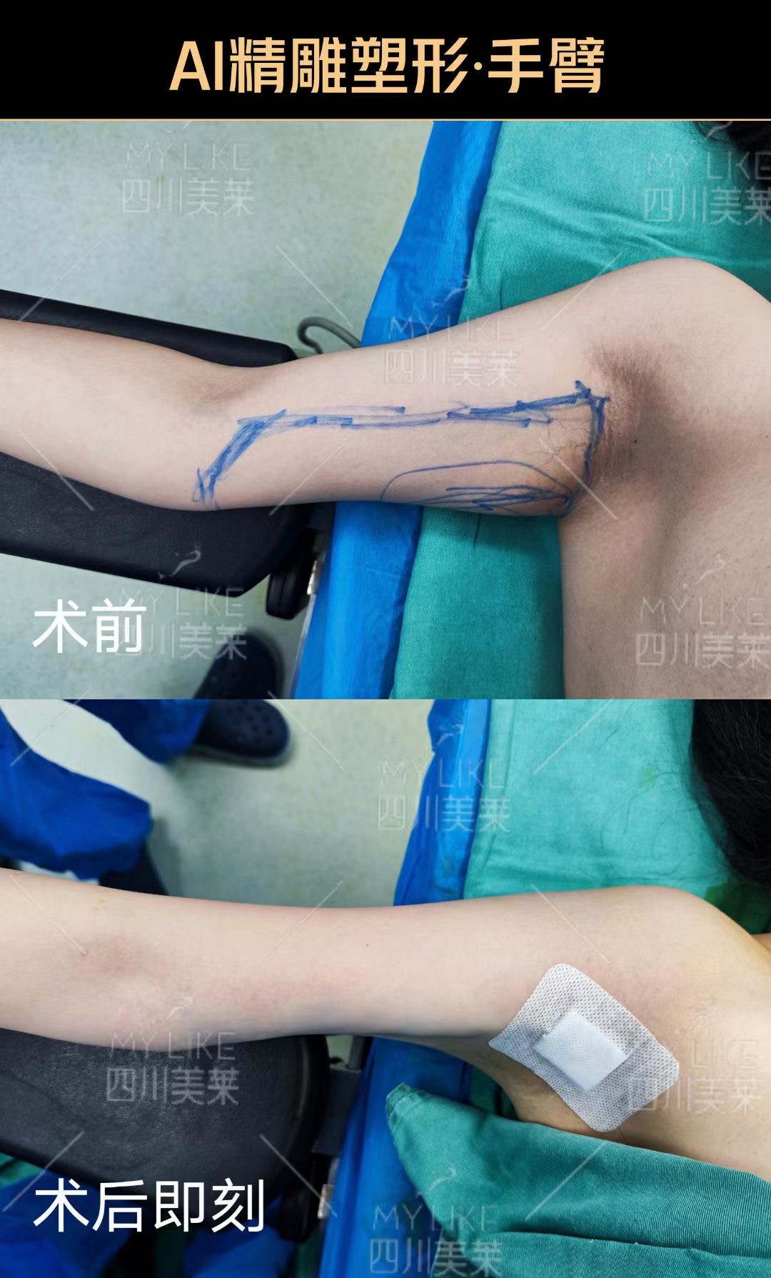 蔡躍波吸脂價(jià)格對(duì)應(yīng)的術(shù)后保護(hù)：讓每一筆費(fèi)用都有“售后”