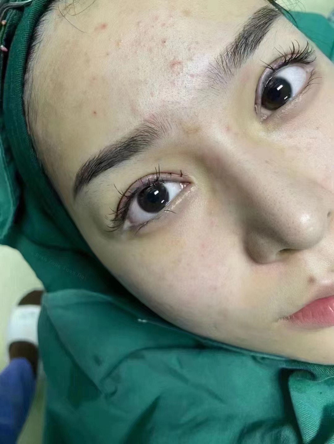 北京师丽丽和李燕谁修复双眼皮最厉害？揭秘两位专家修复双眼皮的精湛技艺与显著成效 