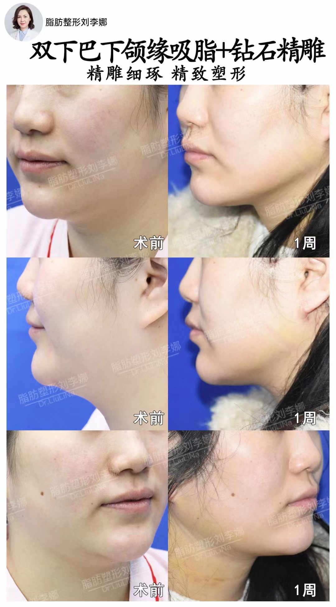 上海范榮杰醫(yī)生和九院魏皎哪個好？自然精致派vs學(xué)術(shù)資深黨，鼻整形選對不踩雷！