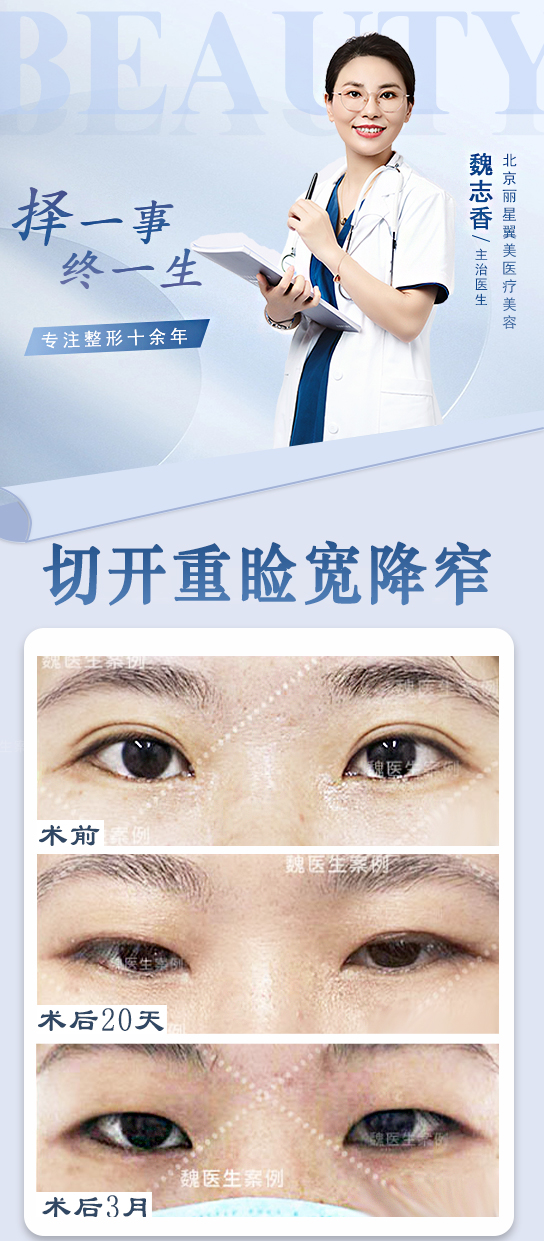 石家庄美莱医学美容医院：连锁品牌的修复魅力