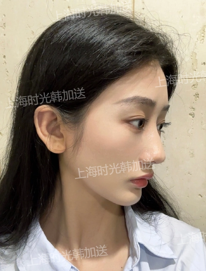 如何根據(jù)自身需求選擇合適醫(yī)生