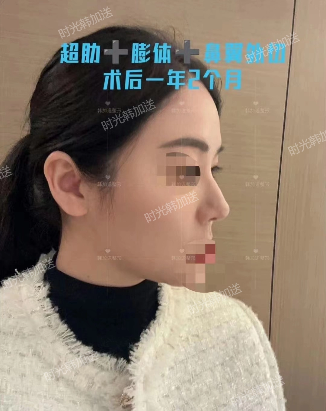 上海徐永丰的成功实例