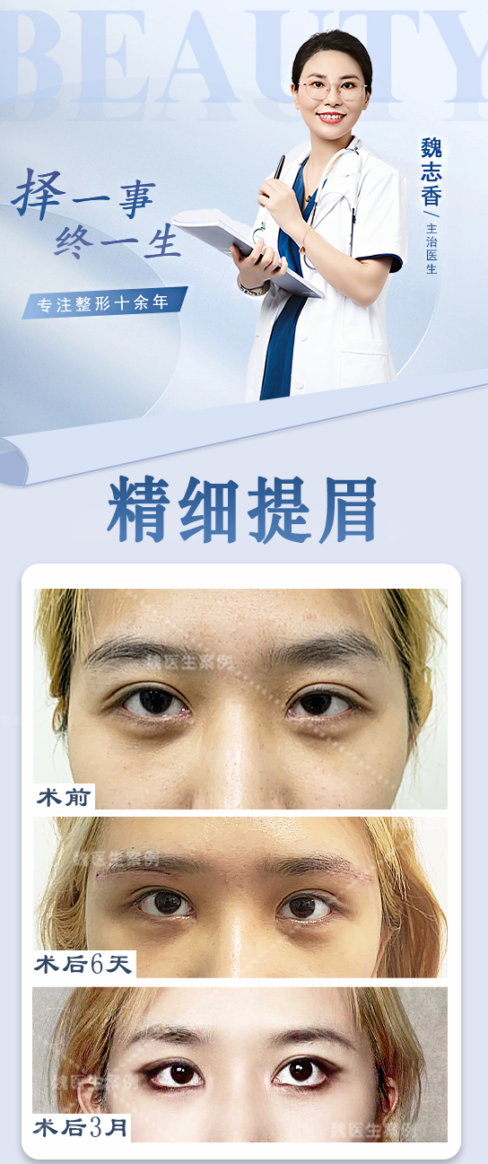 北京袁强博士拉皮面诊地址大揭秘:袁强博士坐诊时间与预约方式