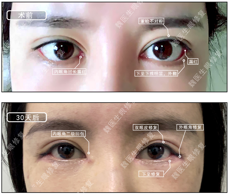 河北省人民医院：自然风格修复骨干医生