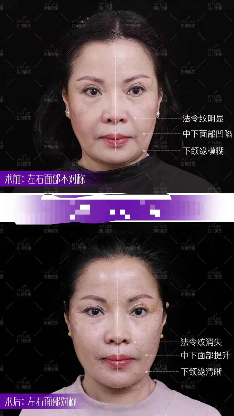 成都李建钢医生的简历如何？