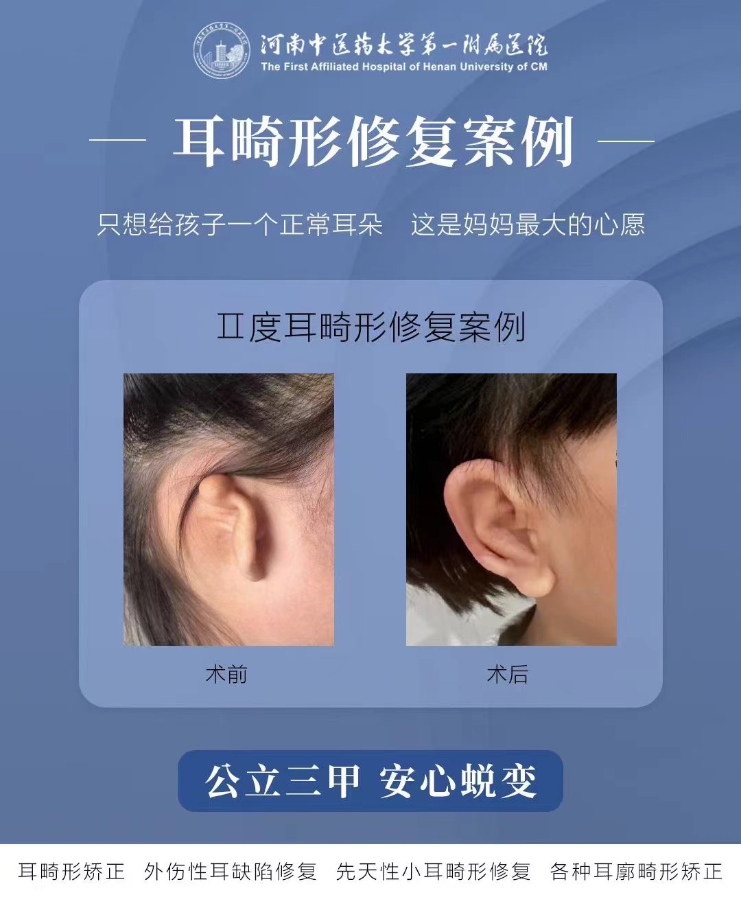 四川省人民医院眼科的专精优势