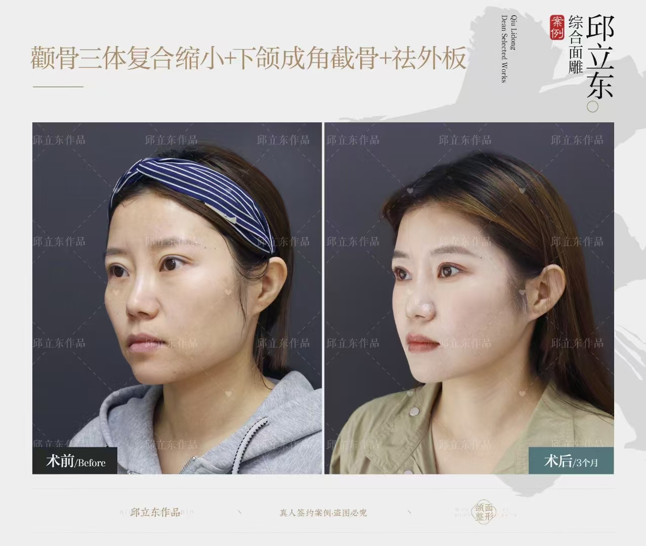 北京师丽丽是谁？她在眼修复领域有何背景？