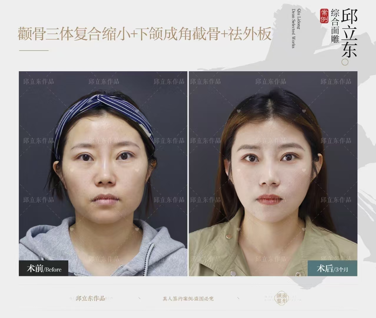 师丽丽医生的不错眼修复技术体现在哪些方面？