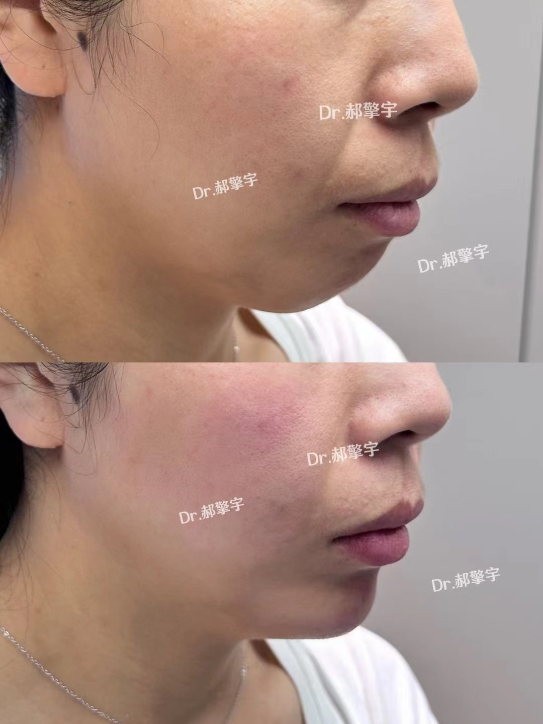 五、上海拜博口腔根管治疗收费情况