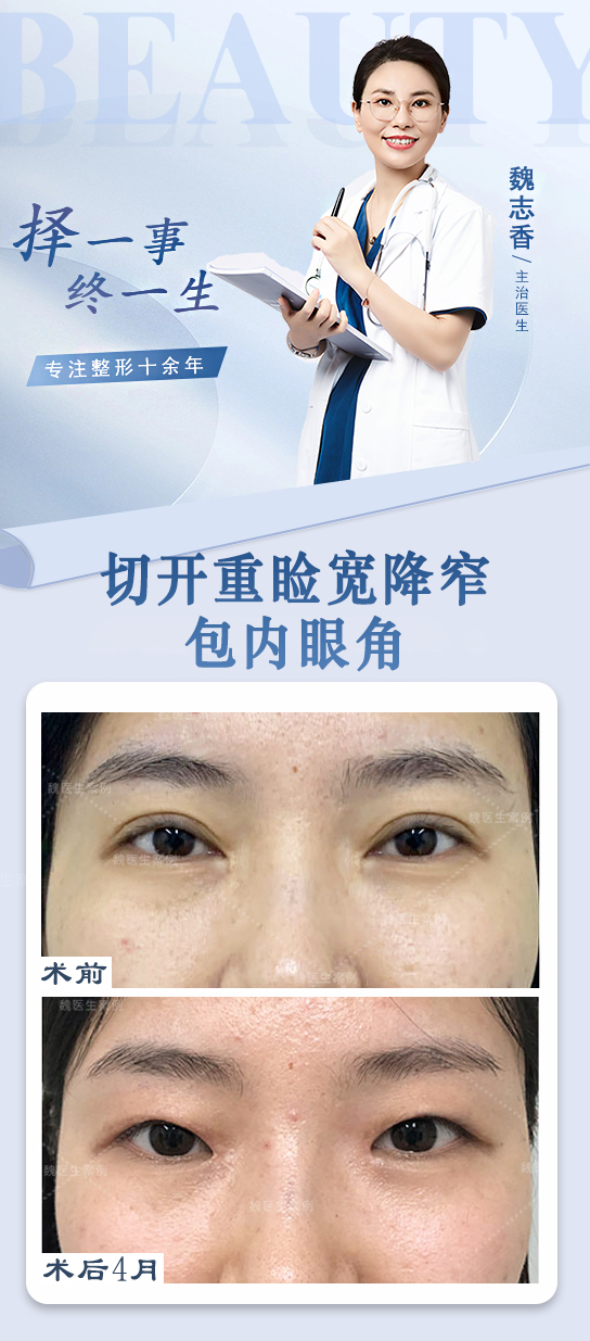 有哪些患者通过师丽丽医生的眼修复手术重获明亮动人双眸？