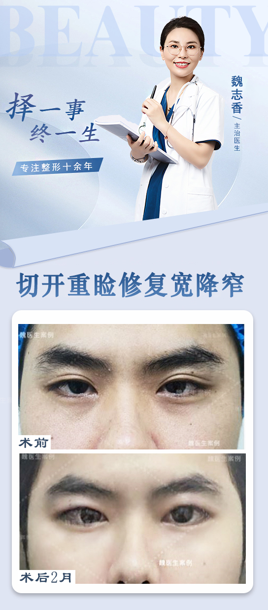 与其他眼修复医生相比，师丽丽医生的优势在哪里？www.8682.cc