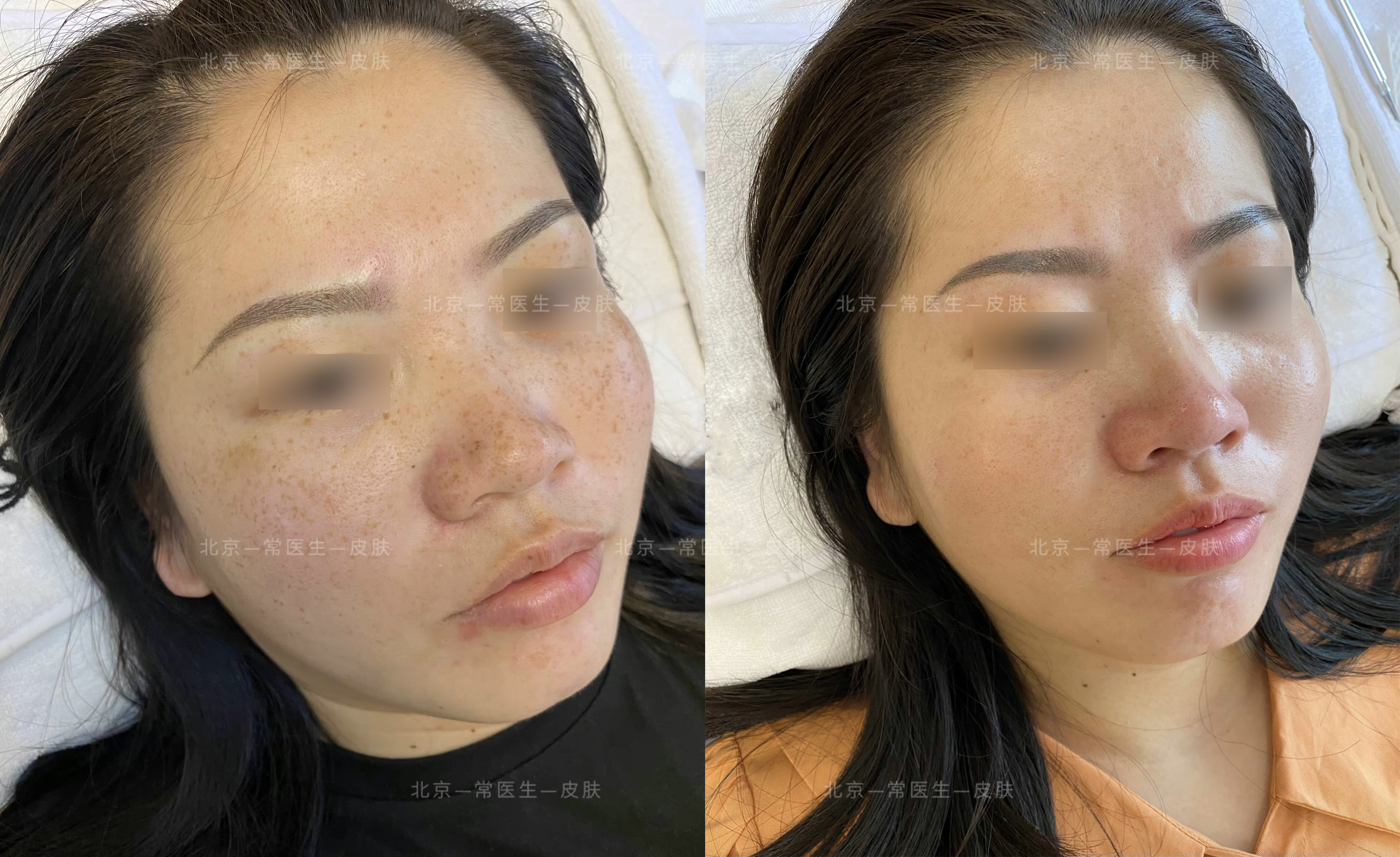 师丽丽医生的眼修复手术费用如何？