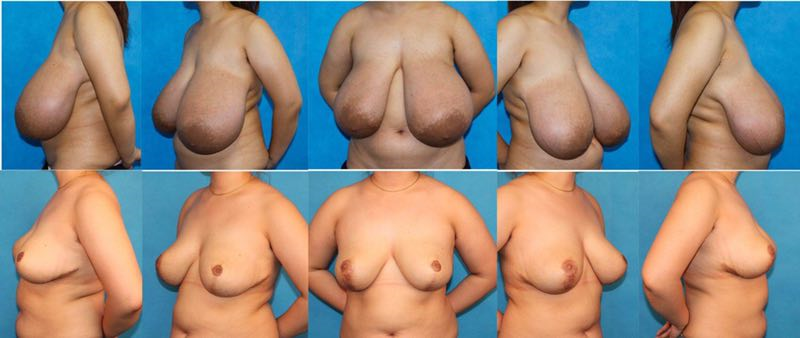 五、選擇昆明華美美萊整形醫(yī)院激光祛斑的注意事項