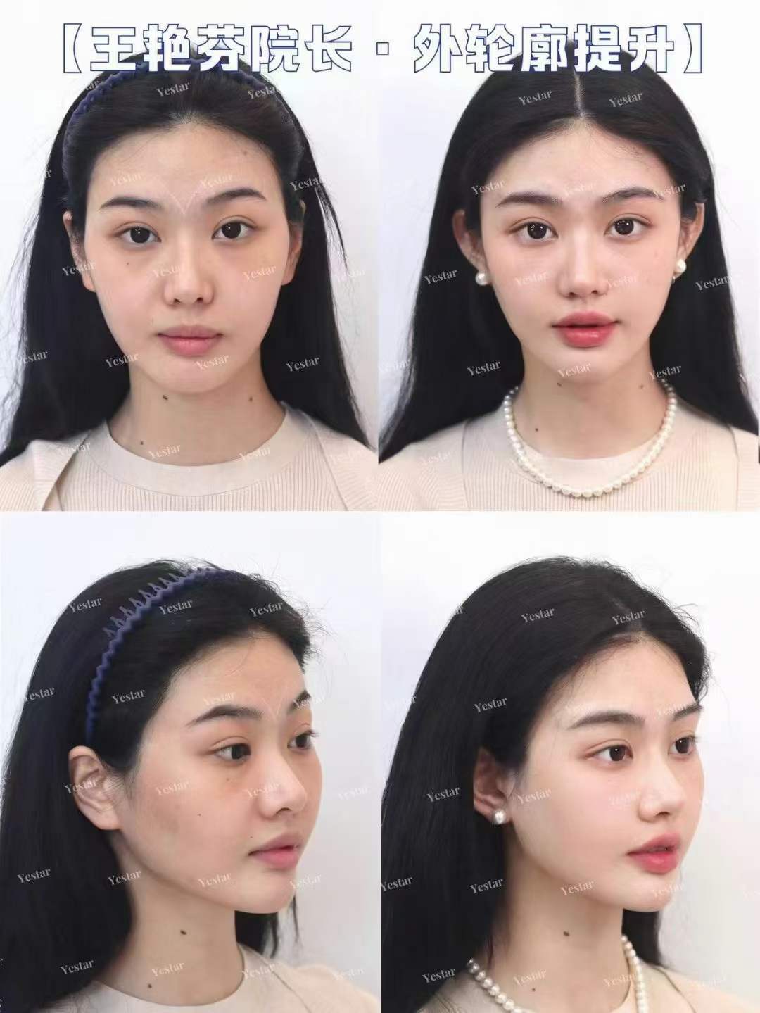 2026年昆明美容院排行前十名揭晓，这4家本地知名医院凭技术与口碑脱颖而出