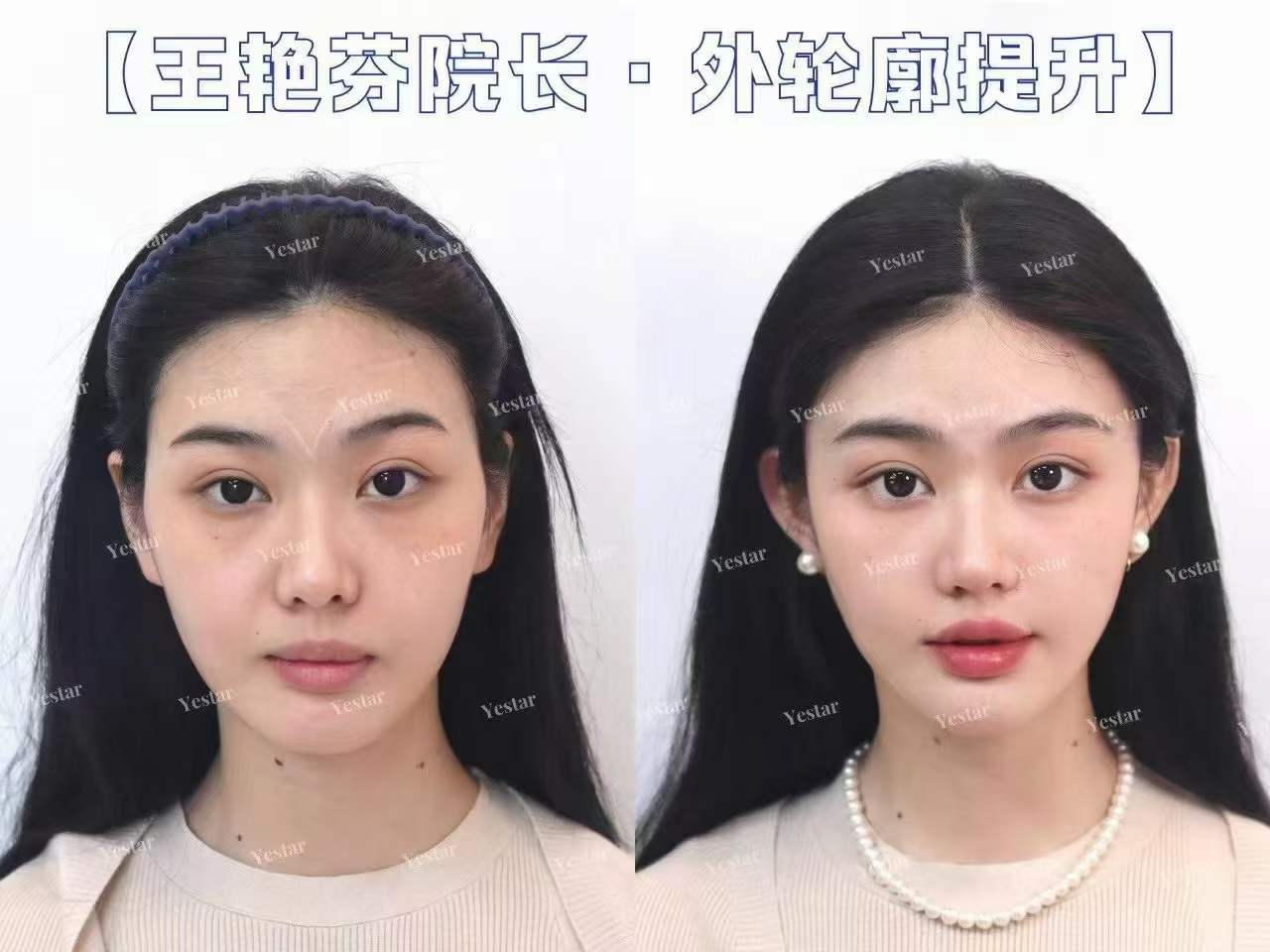 昆明市第一人民醫(yī)院整形外科：歷史悠久的特色?？? style=