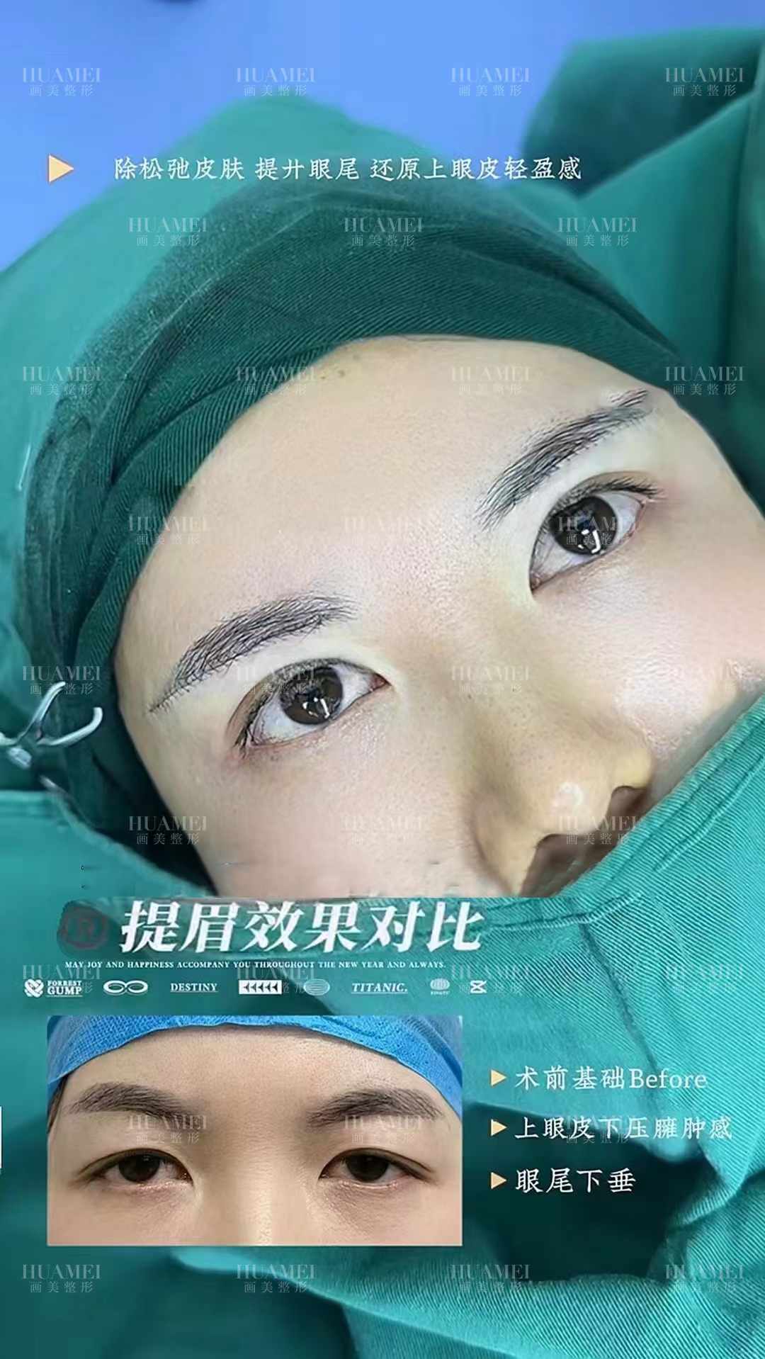 四、杨占风医生黑金超光子技术的收费情况