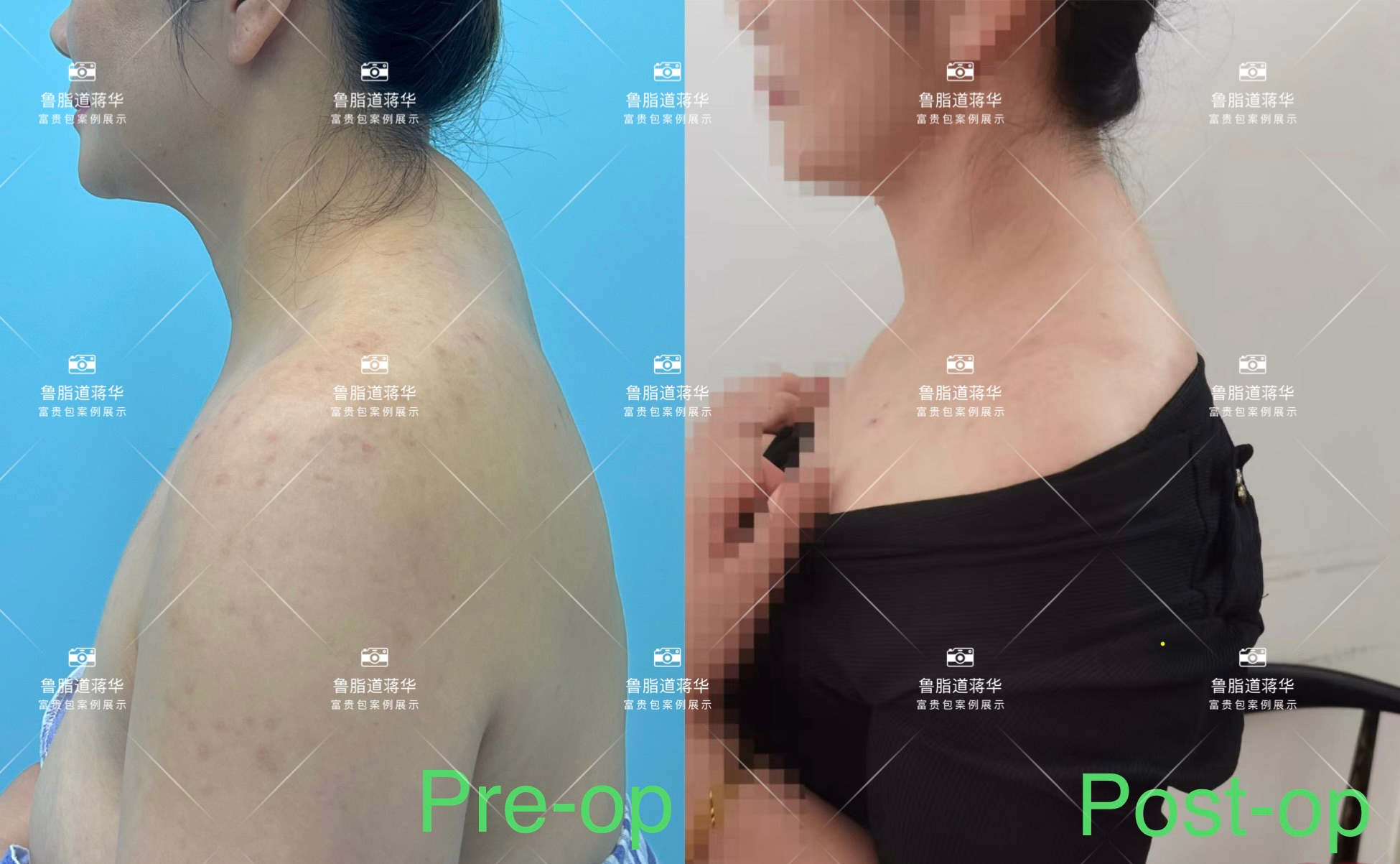 上海戴傳昌做鼻子優(yōu)勢分析