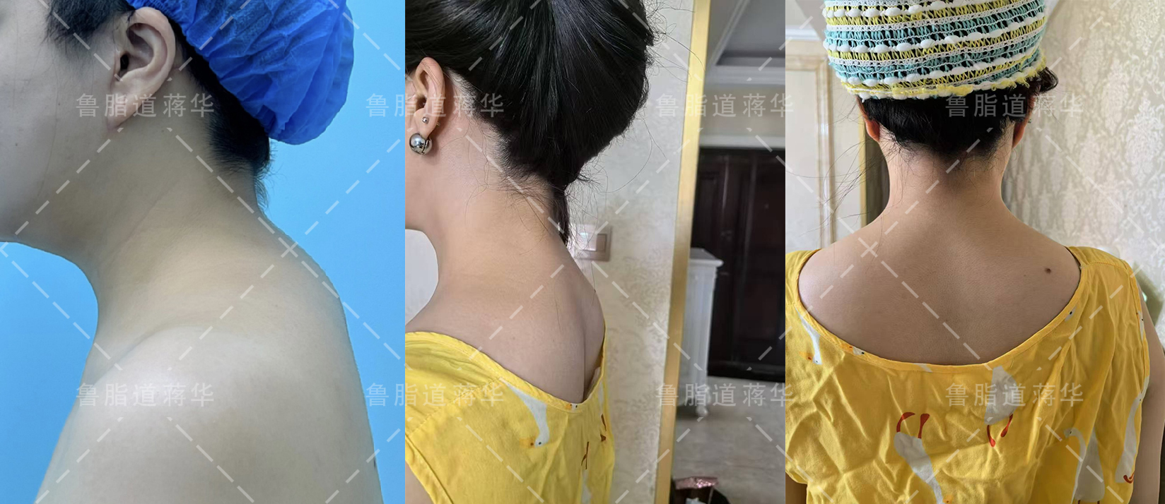 上海李鴻君做鼻子優(yōu)勢分析