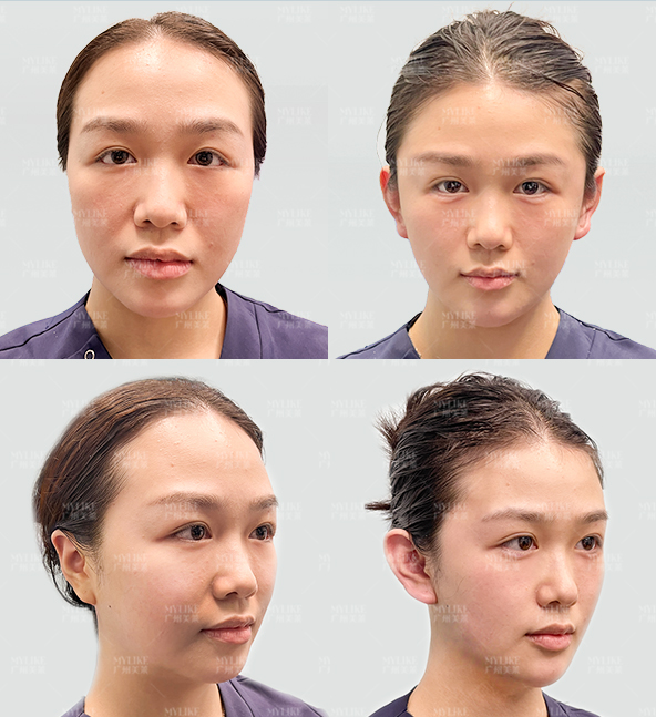 南京连天美美容医院：艺术美学融合，丰唇成效突出www.8682.cc