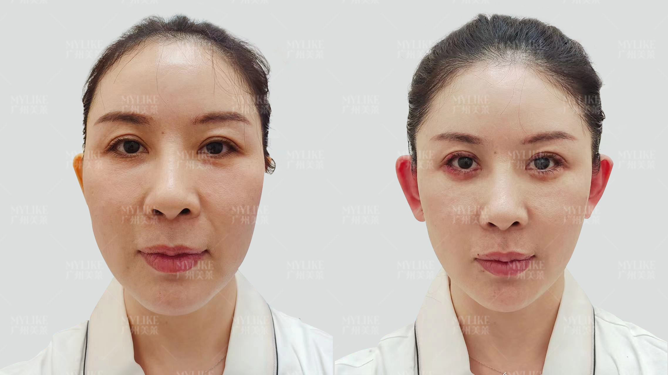 南京华美美容医院：经验多，深入沟通