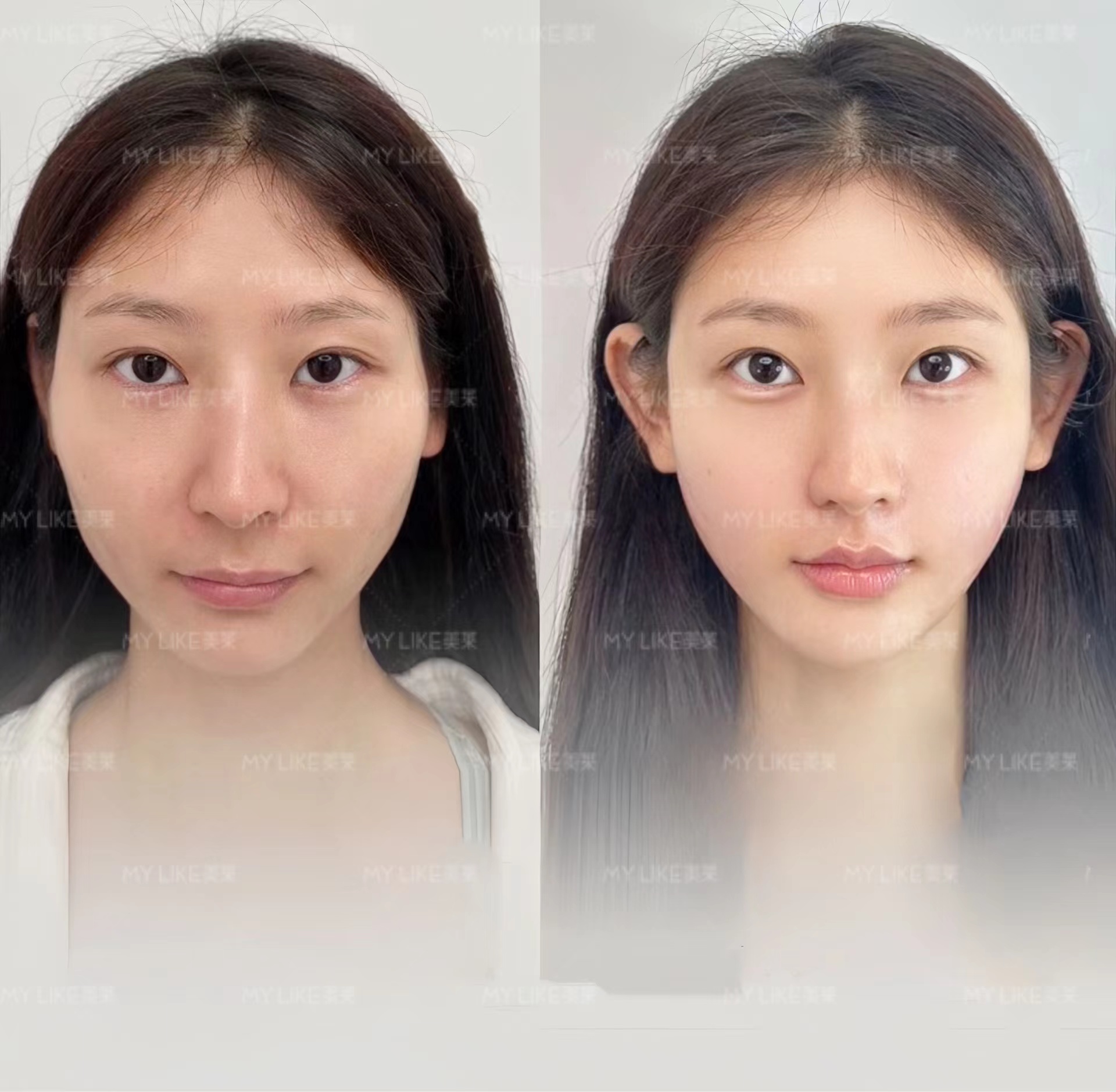 南京美莱整形美容医院：分层定制方案，贴心术后服务