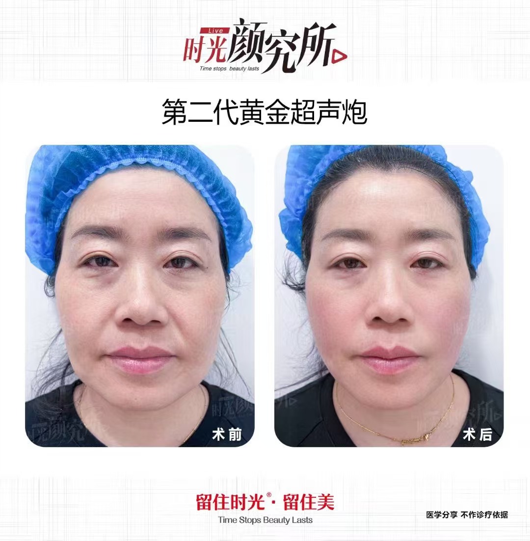 上海海華醫(yī)院預約掛號后的就醫(yī)體驗