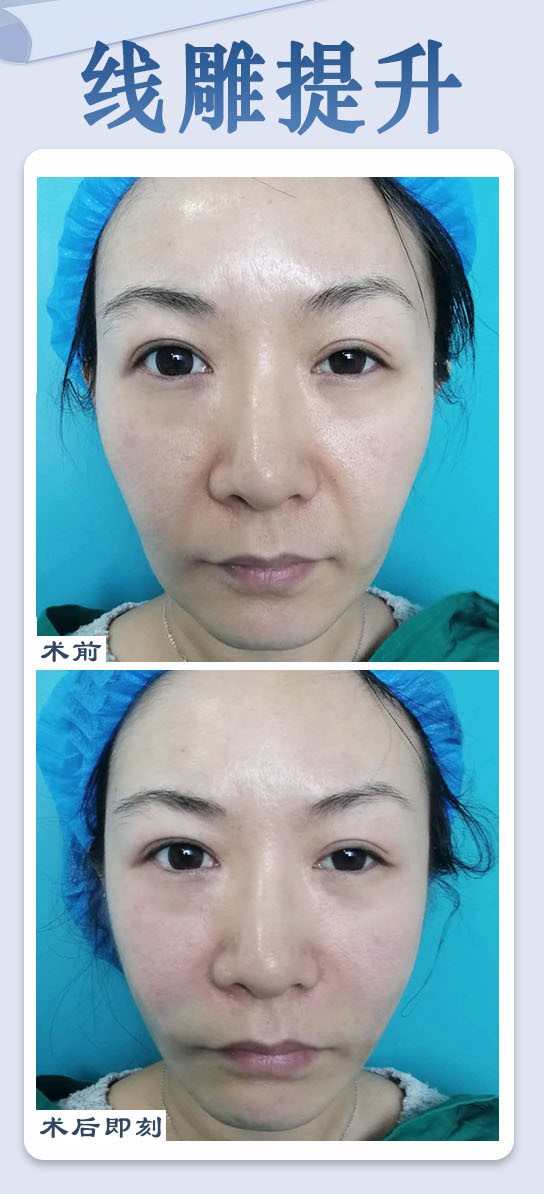 師麗麗和魏志香、張冰潔三位哪個(gè)口碑好？揭秘醫(yī)美整形界三位醫(yī)師的良好口碑真相 