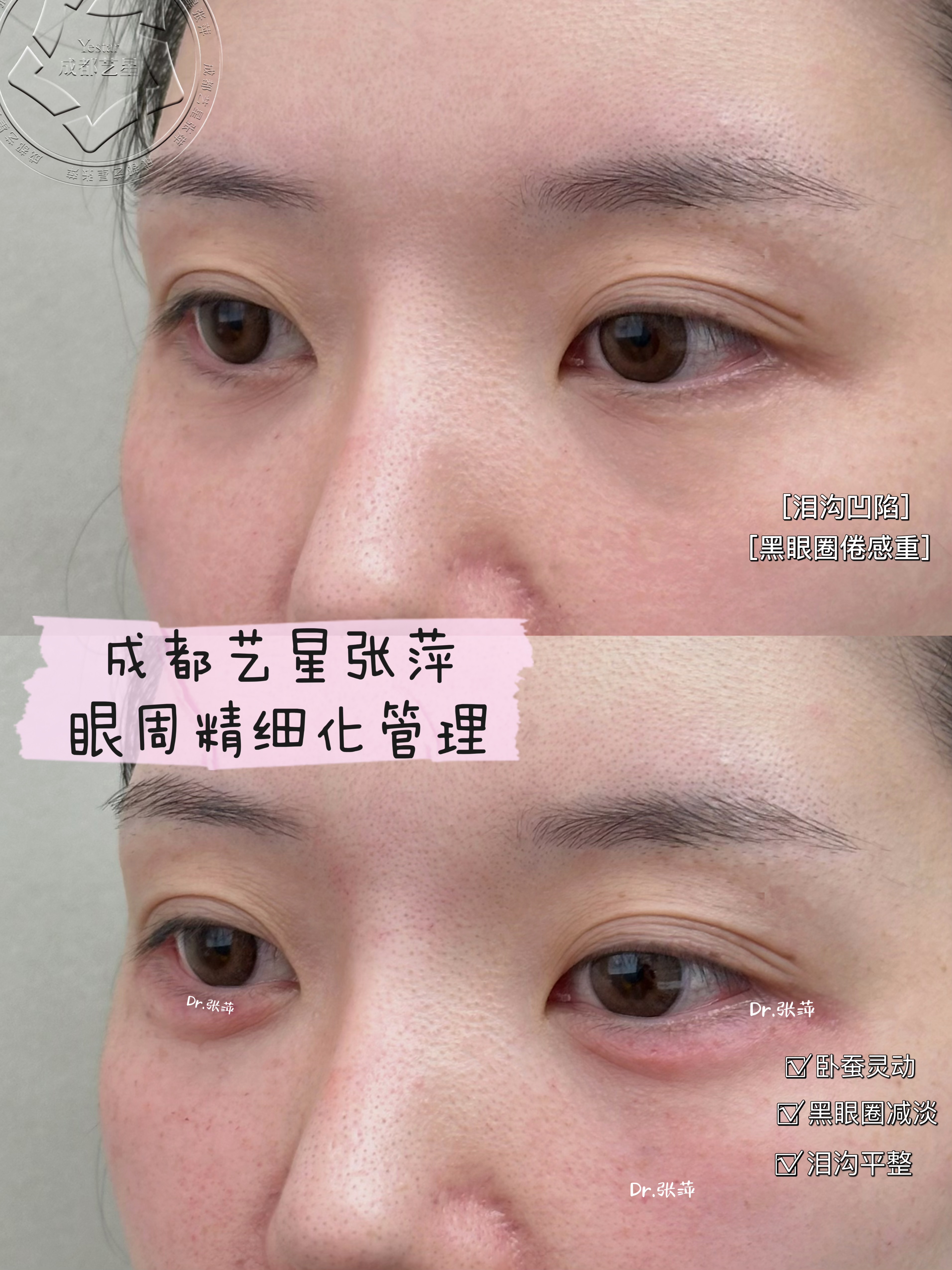 北京丰联丽格属于什么档次？眼整形界翘楚，以精湛技艺与优质服务树立医美行业新标杆 