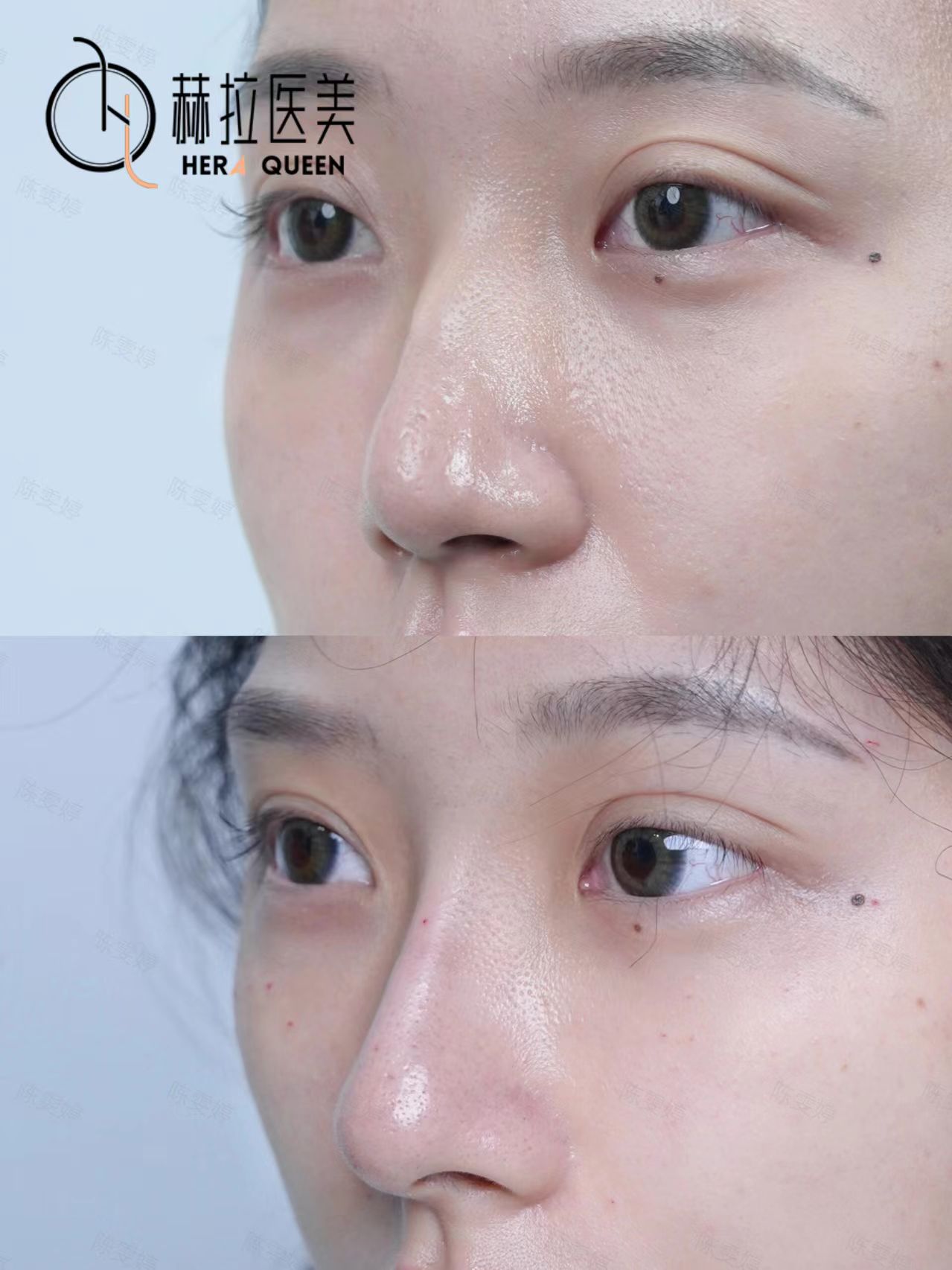 上海徐永丰医生的技术优势