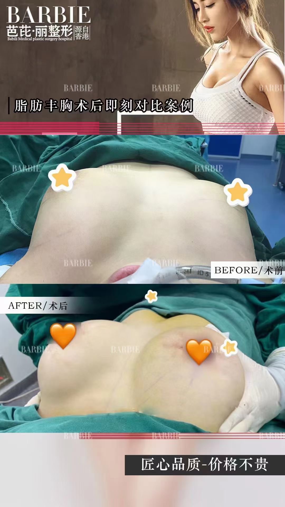 南宁爱思特医疗美容医院：创新技术引领者