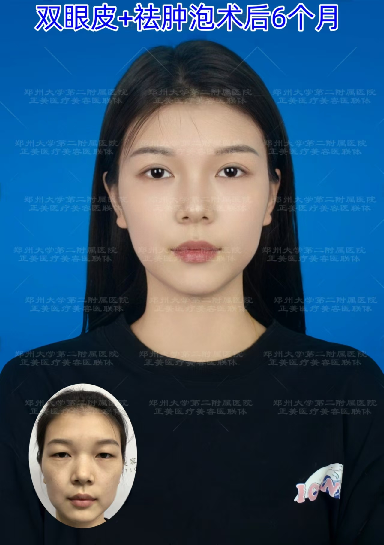 与其他医美机构相比，北京丰联丽格的优势在哪？