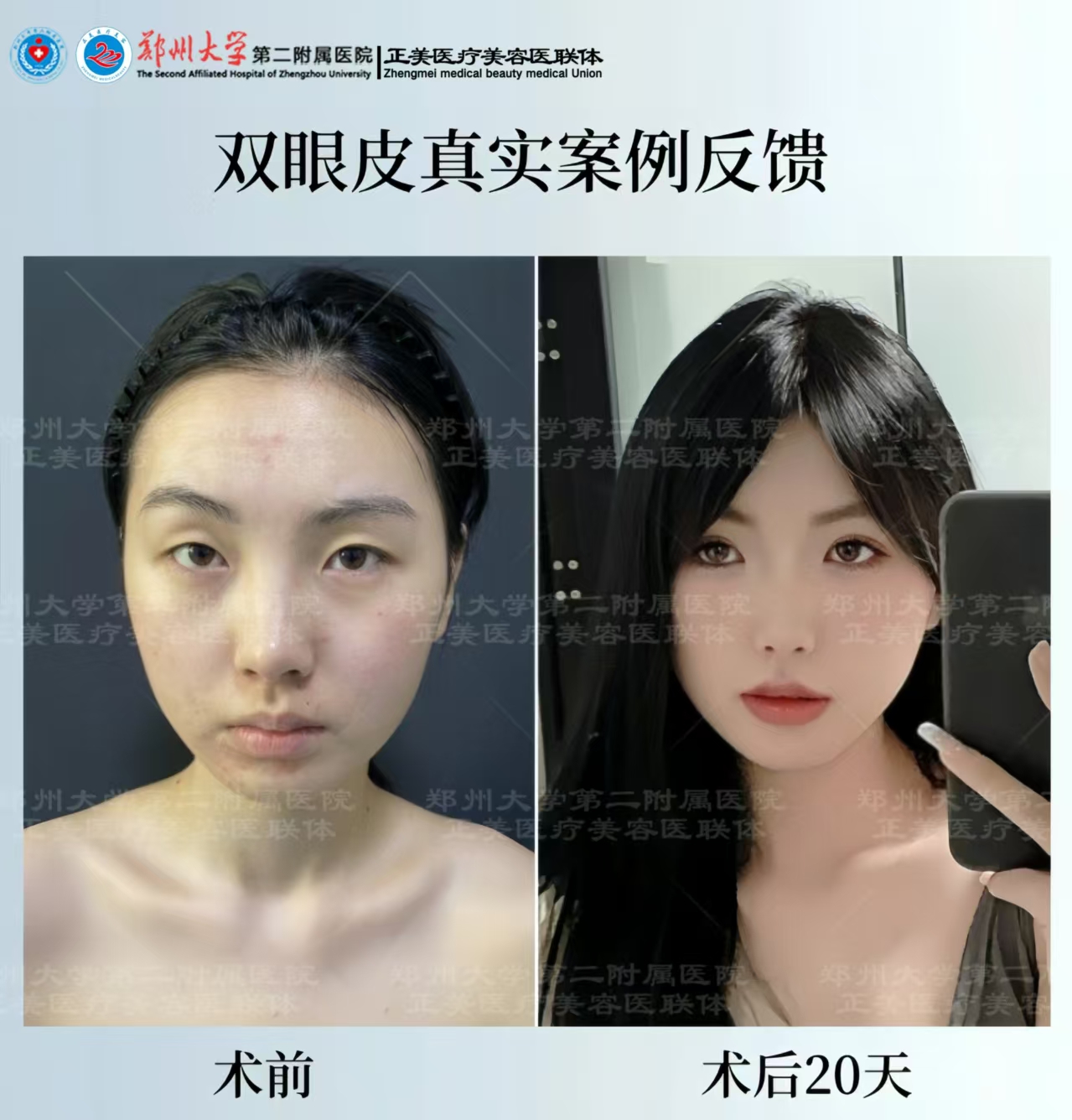 求美者选择北京丰联丽格能获得什么？