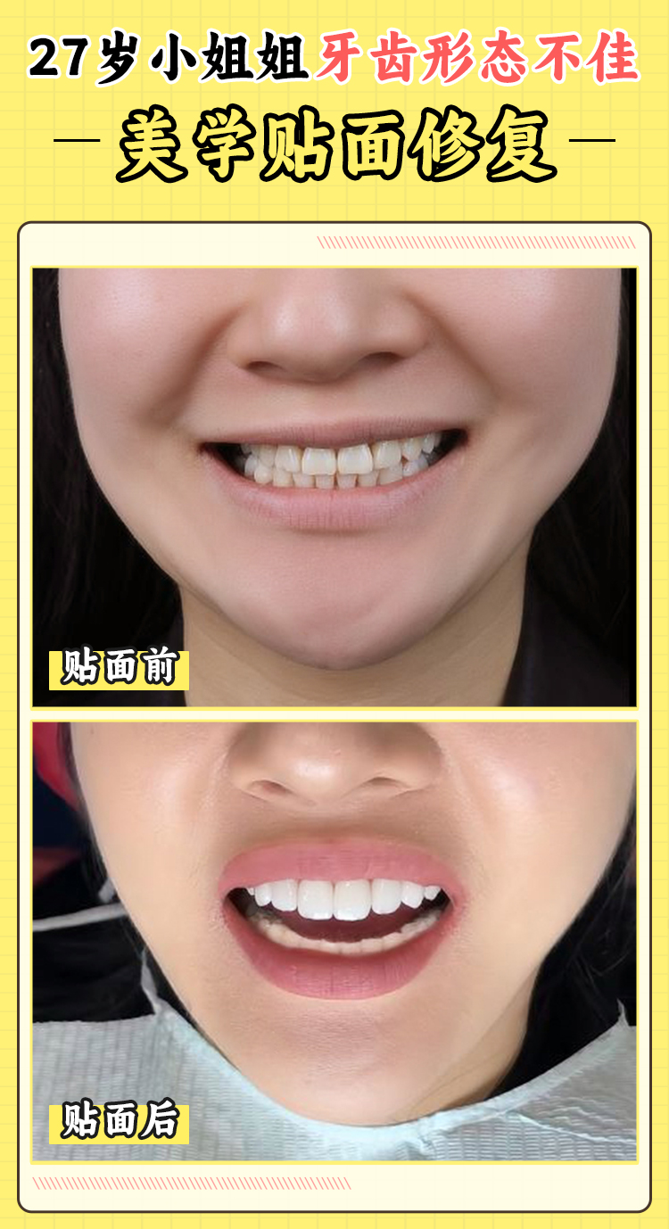 珠海补牙哪个医院好？九龙/中大五院/六和口腔等口碑机构推荐