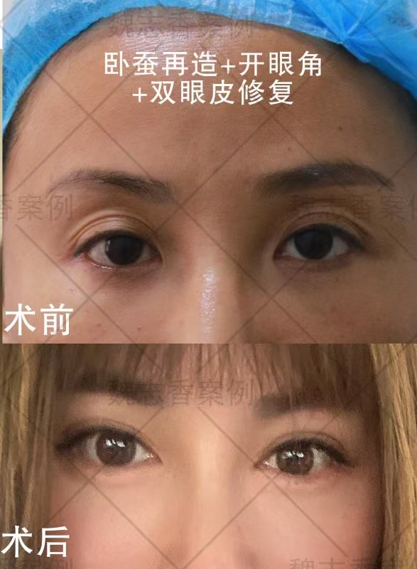 患者實(shí)際反饋大揭秘