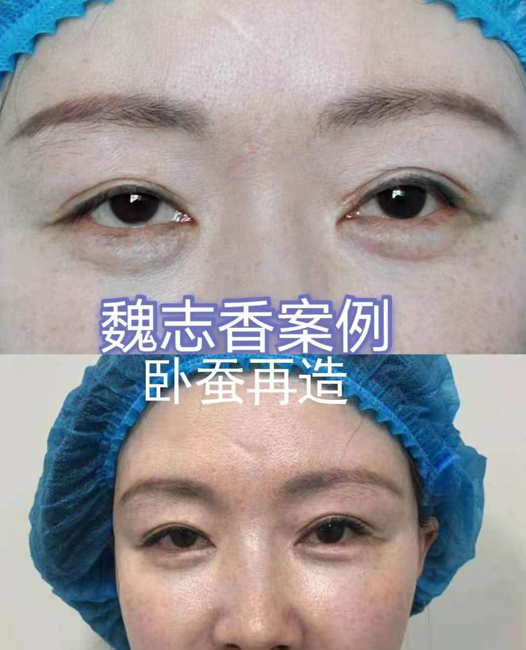 綜合對(duì)比，誰(shuí)的口碑更勝一籌？