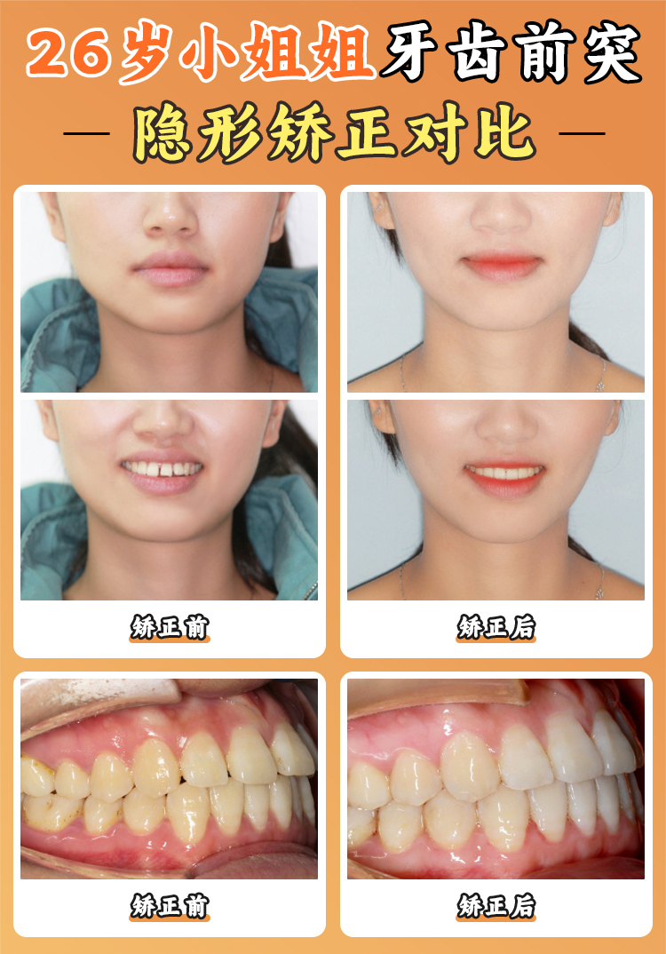 选择北京永林口腔医院宋立文医生有什么优势?www.8682.cc