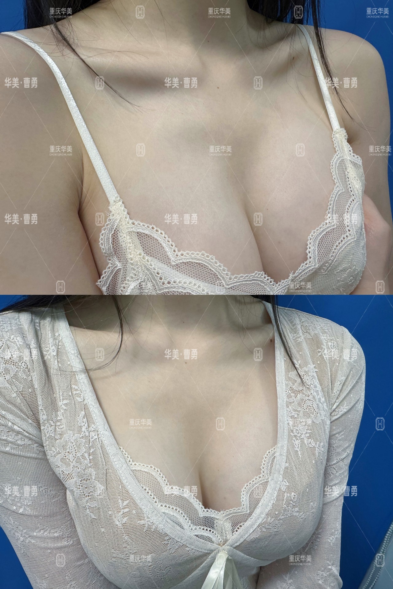 昆明吴氏嘉美：老牌美容院的吸脂与修复传奇