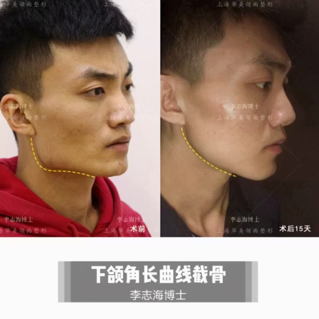 昆明华美美莱：一站式美容服务的优选之地